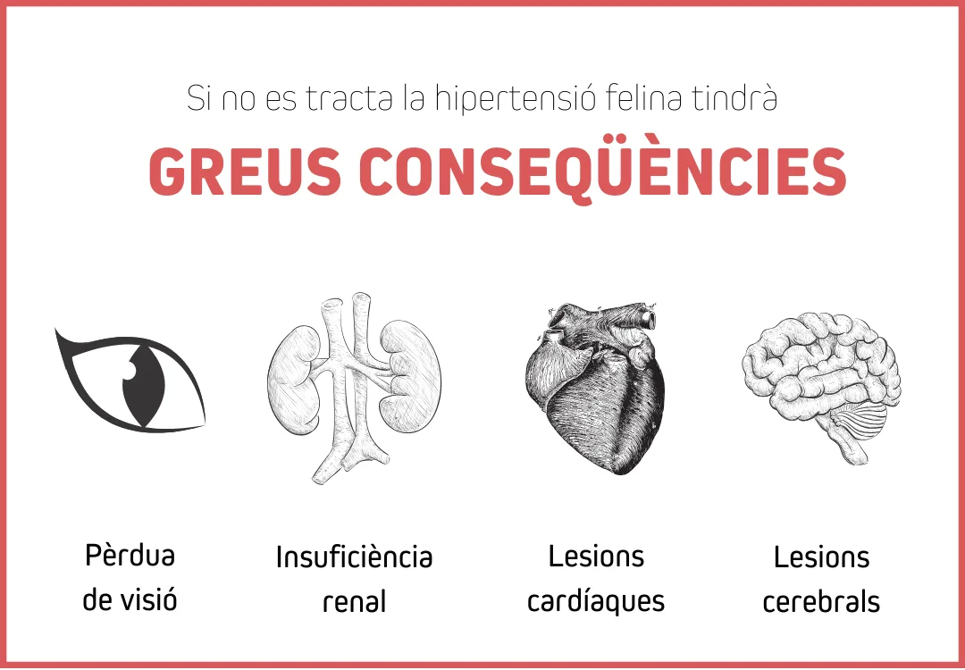 hipertensio imatge 2
